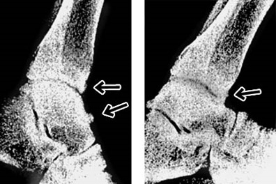 フットボーラーズ アンクル Sports Medicine Library ザムスト Zamst