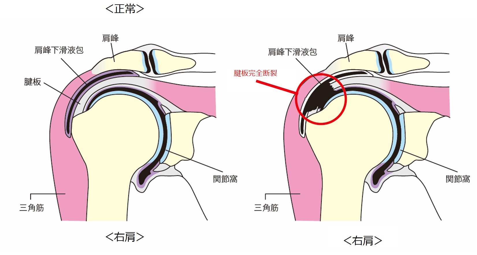 肩の解剖図