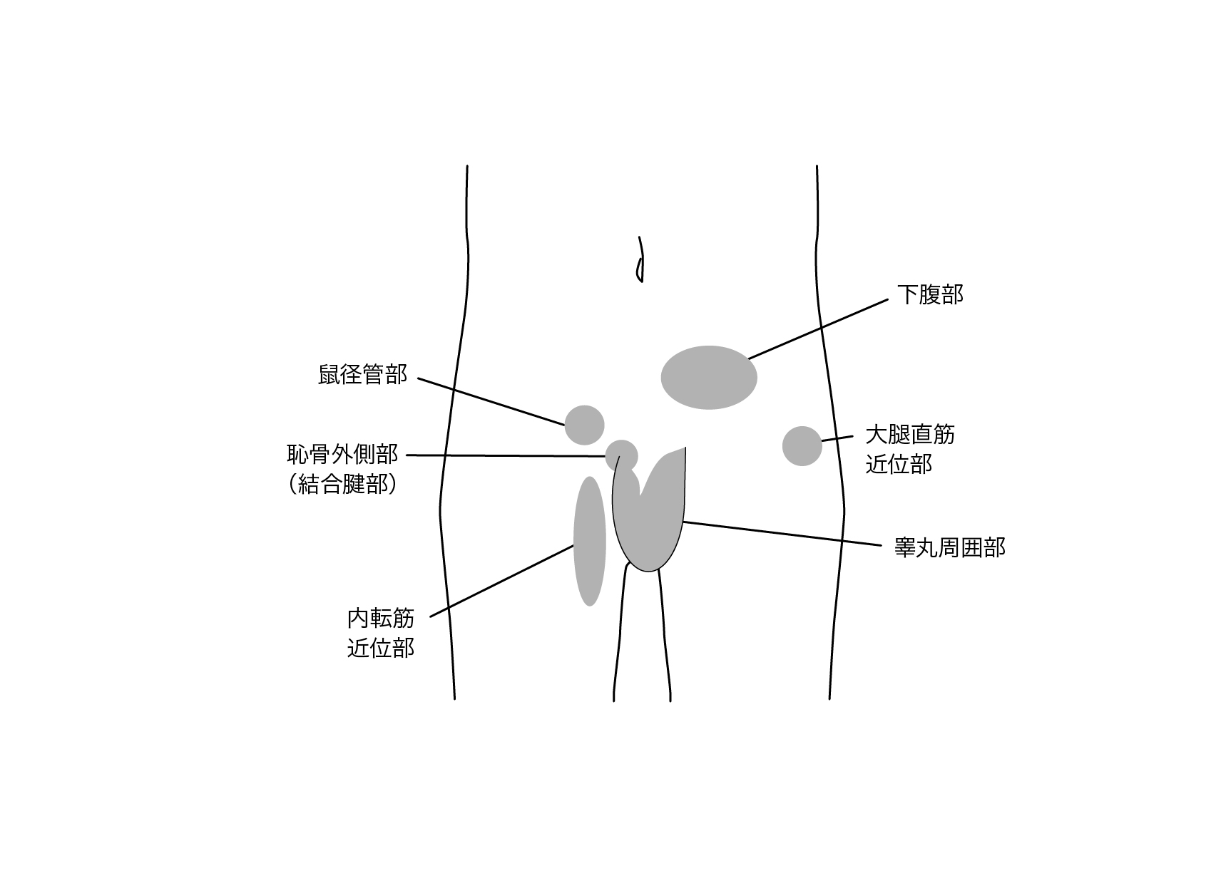 鼠径部痛症候群 グロインペイン症候群 Sports Medicine Library ザムスト Zamst