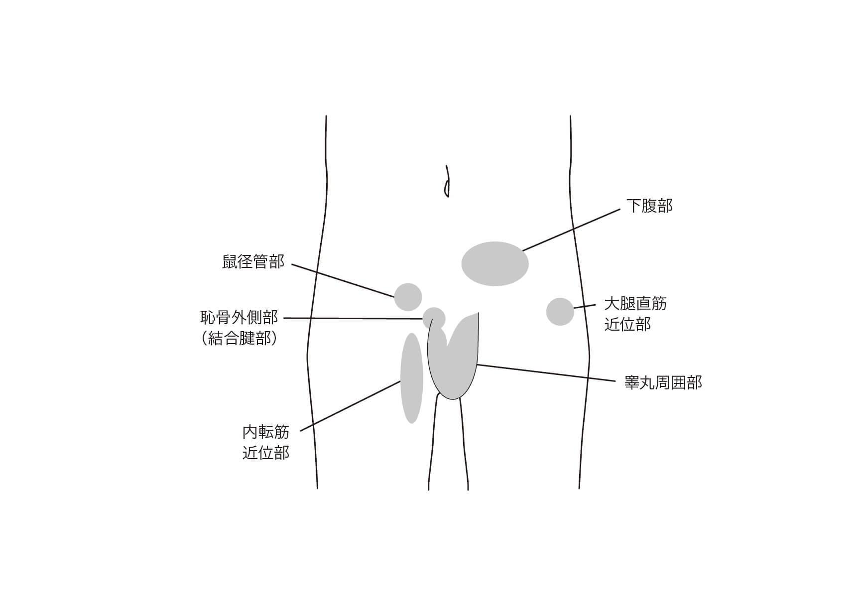 鼠径部周辺の疼痛領域