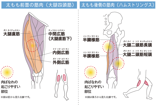 肉ばなれ